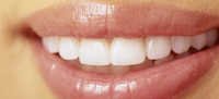 Digital Smile Designing