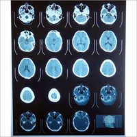 Radioactive Film - Photographic Film, Variable Sizes, Black | Clear Image, Actual Color, Waterproof, Durable, Medical Imaging