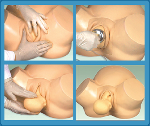 Vacume Delivery Model