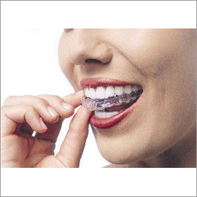 Dental Braces Treatment