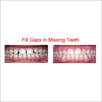 Dentistry Treatments