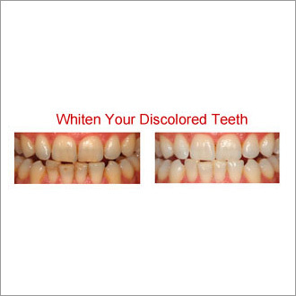 Cosmetic Dentistry Treatments Services