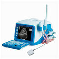 Digital Ultrasound Scanner