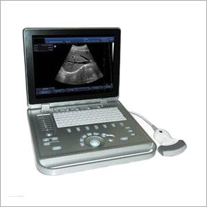 Portable Ultrasound Machine