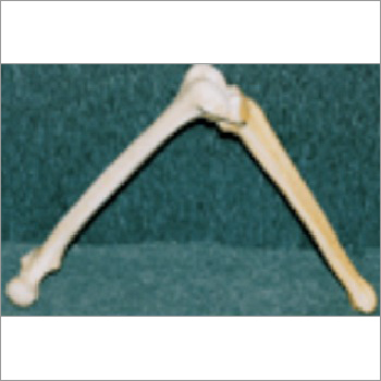Saw Bones