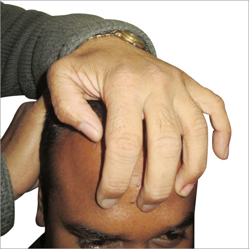 Acupressure Eye Points