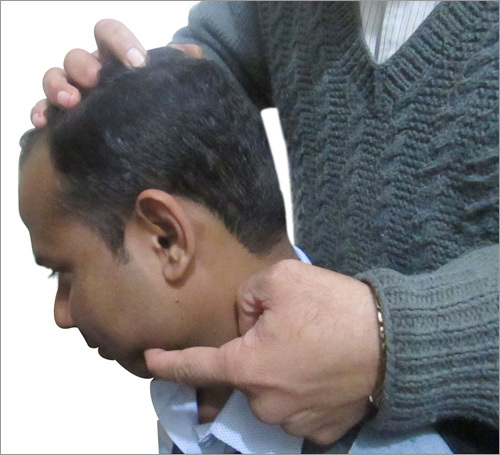 Jaw Acupressure Massage