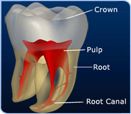 Single Sitting Root Canal Treatment By BANSAL DENTAL HOSPITAL (Creating healthy smiles since 1999)