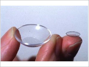 Contact Lenses for Keratoconus