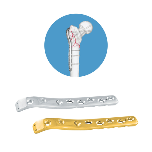 Locking Proximal Femur Plate