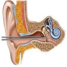 Coachlear Implant Surgery