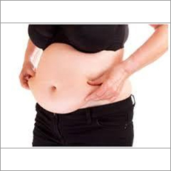 Tummy Tuck Surgery