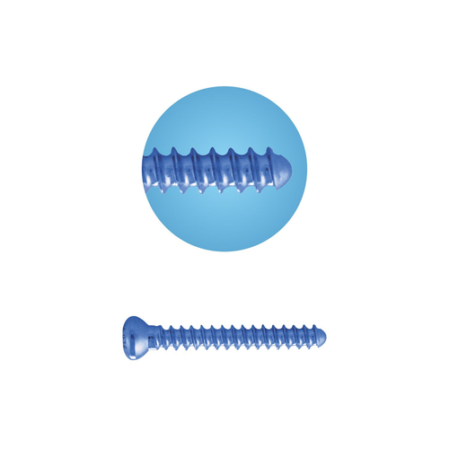 Cortical Screw 4.5 mm Dia. - Titanium, 14 TPI | Biocompatible, High Strength, Precise Fit, Variable Head & Length