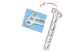 Oblique Angle Locking Screw