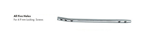 Interlocking Femur Nails