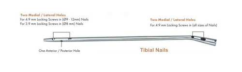 Tibial Intramedullary Nails