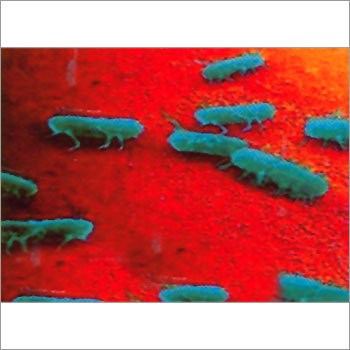 Salmonellosis Water Borne Diseases