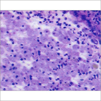 Amoebic Dysentery Water Borne Diseases