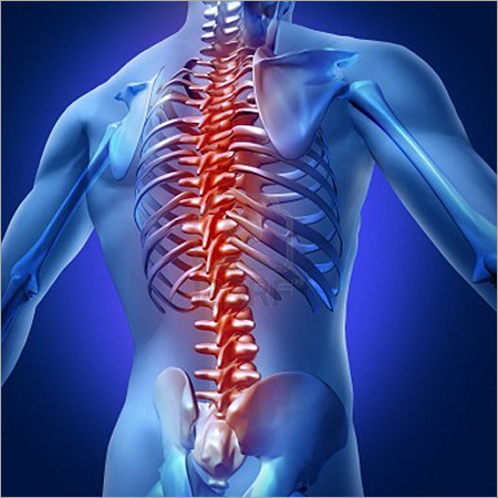 Human Backache Homeopathy Treatment