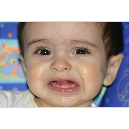 Homeopathic Teething Troubles Treatment