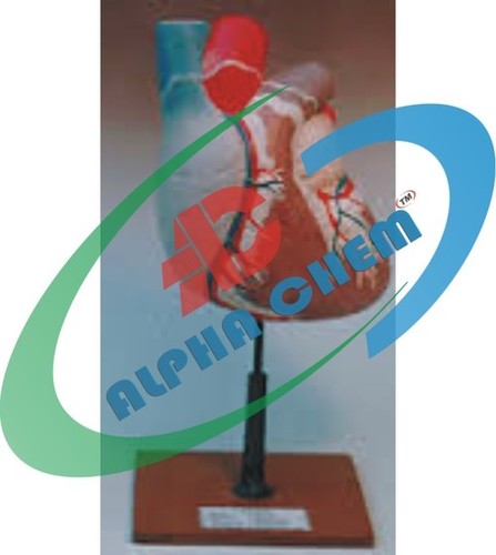 Human Heart Model Three Times Enlarged - PVC Material, Red Color, Dissectable Two Parts | Detailed Anatomy, Educational Tool, On Stand