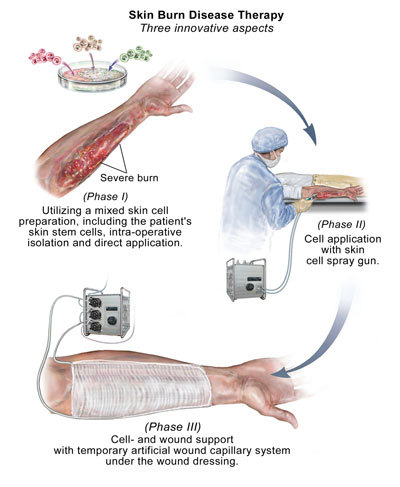 Surgical Dressing