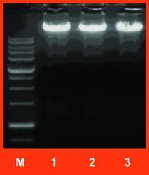 Agarose Gel - TAE/TBE Buffer, EtBr Staining, UV Visualization, Constant Voltage | DNA Analysis, Size Separation, Fragment Analysis, Quality Control