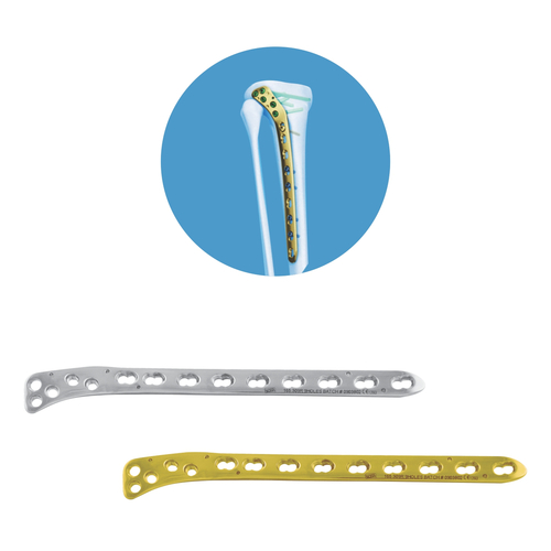 Lateral Tibial Locking Plate