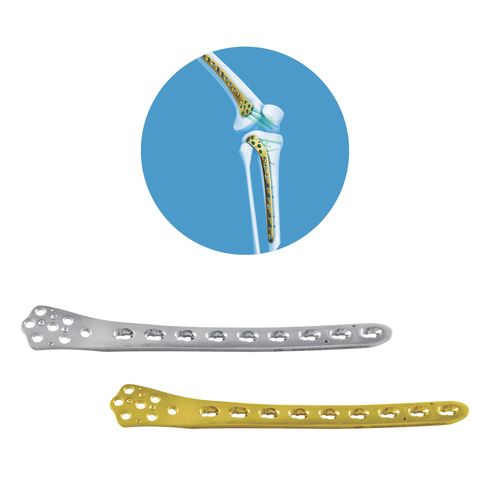 Locking Distal Femur Plate