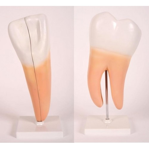 Expansion Modelof Human Teeth