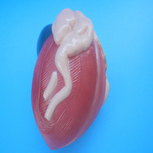 Expansion Model of Urinary Bladder - High Class Material, Red, Medially Dissected | Male Bladder with Prostate Gland Surrounding Urethra