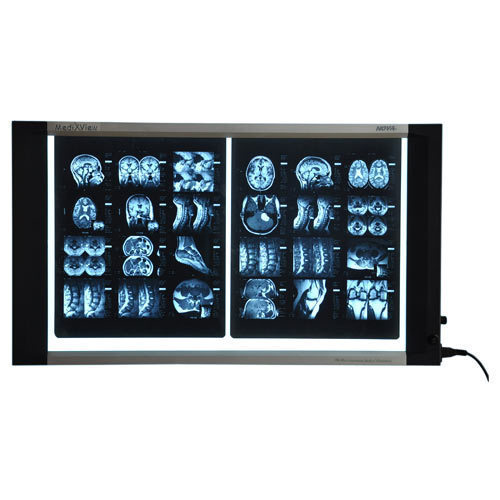 Two Screen X-Ray Viewer