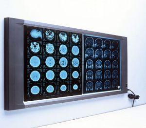 Digital X-Ray Viewer