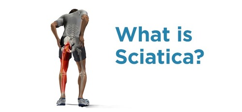 Homeopathic Sciatica Treatment