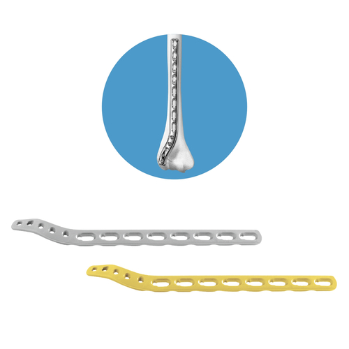 Locking Extra Articular Distal Humerus Plate