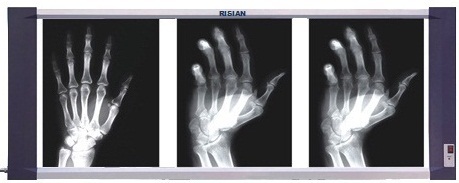 RISIAN Triple Section LED X Ray Film Viewer