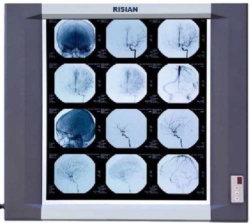 RISIAN Single Section Led X Ray Film Viewer
