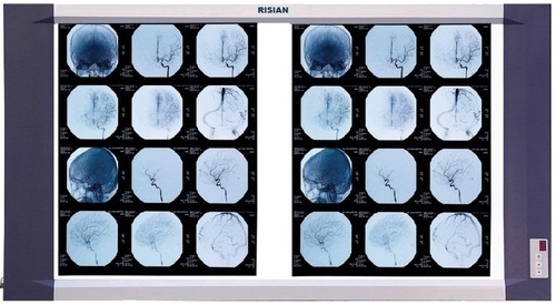 RISIAN Double Section LED X-Ray Film Viewer