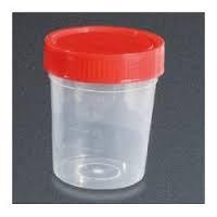 Sample Urine Container