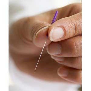 ACP Acupuncture Products