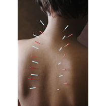 ACP Acupuncture Needle Tube Pck. 100pc 1 