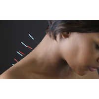 Acp Acupuncture Needle-tube Pck 100 Pc -.5 - Color: Sliver