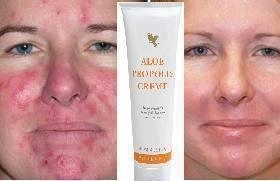 Propolis Creme