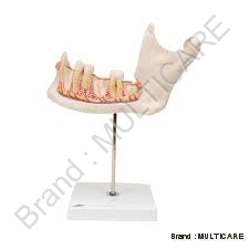 Half Lower Jaw - PVC, 15x10x8 cm, Off-White | Removable Teeth, Detailed Anatomy, Metal Stand
