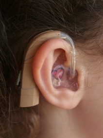 Multi Channel Digital Hearing Aid