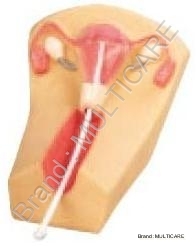 IUD Training Model