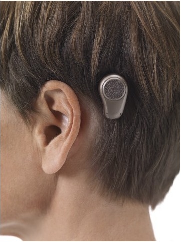Bone Anchored Hearing System