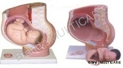 Human Female Pregnant Pelvis Section with Fetus