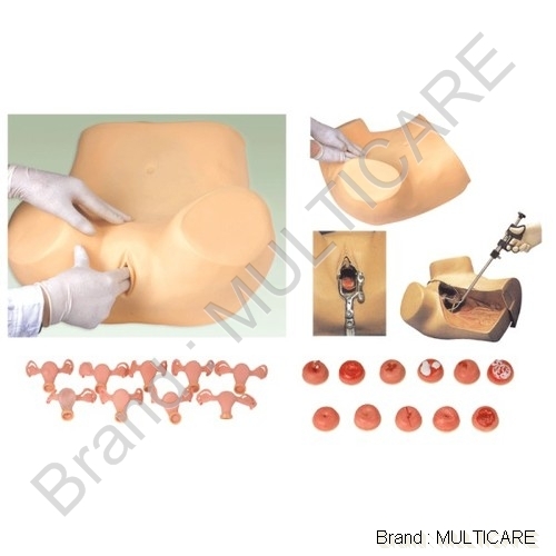 Gynecological Training Model