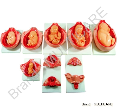 Development Process for Fetus - PVC & Synthetic Rubber Red Variable Size | Ten Parts Fetal Growth Uterus Model Educational Tool